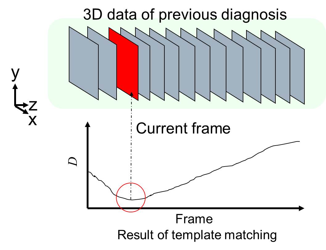 Position_detection_in_zaxis