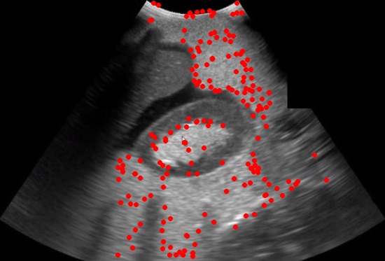 Ultrasonography Training System