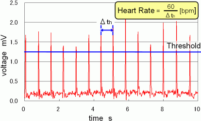 Fig.2.5 ECG