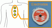 Fig.2.4 Electrode