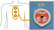 Fig.2.4 Electrode