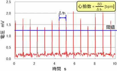 Fig.2.5 ECG