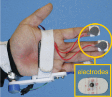 Fig.2.11 SRC electrode