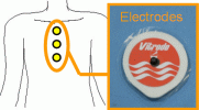 Fig. 2.5 Electrode